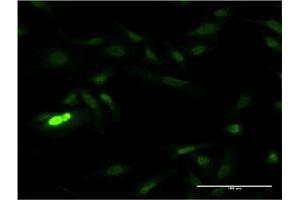 Immunofluorescence of monoclonal antibody to SUB1 on HeLa cell. (SUB1 Antikörper  (AA 32-124))