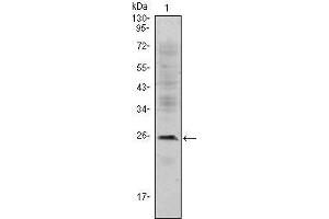 Western Blot showing CD3E antibody used against Jurkat (1) cell lysate. (CD3 epsilon Antikörper)