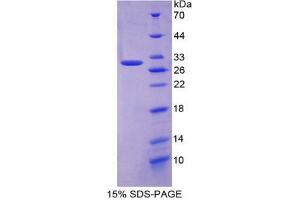 SDS-PAGE analysis of Mouse APP Protein. (APP Protein)