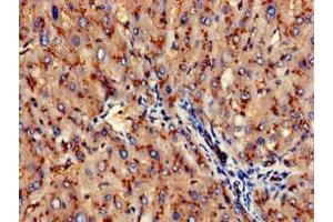 Immunohistochemistry of paraffin-embedded human liver tissue using ABIN7144005 at dilution of 1:100 (CD13 Antikörper  (AA 34-219))