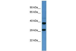 Western Blotting (WB) image for anti-Somatostatin Receptor 2 (SSTR2) (C-Term) antibody (ABIN2505939) (SSTR2 Antikörper  (C-Term))