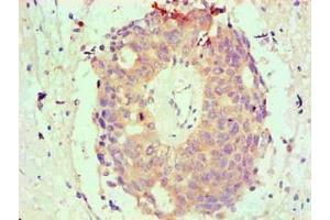 Immunohistochemical of paraffin-embedded Human endometrium tissue using ABIN7145293 at dilution of 1:200 (BCL2L1 Antikörper)