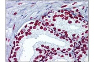 Human Prostate: Formalin-Fixed, Paraffin-Embedded (FFPE) (Histone H4 Antikörper  (acLys5))