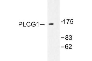 Image no. 2 for anti-phospholipase C, gamma 1 (PLCG1) antibody (ABIN271786) (Phospholipase C gamma 1 Antikörper)