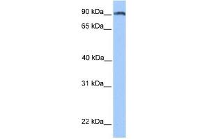 ANKS3 antibody used at 1 ug/ml to detect target protein. (ANKS3 Antikörper  (N-Term))