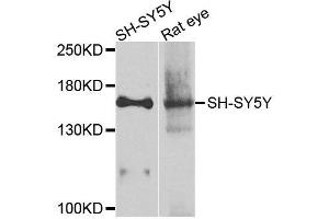Western blot analysis of extracts of various cell lines, using ADCY2 antibody (ABIN6003537) at 1/1000 dilution. (ADCY2 Antikörper)