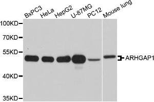 Western blot analysis of extracts of various cell lines, using ARHGAP1 antibody. (ARHGAP1 Antikörper)