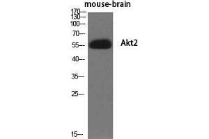 Western Blot (WB) analysis of specific cells using Akt2 Polyclonal Antibody. (AKT2 Antikörper  (Ser138))