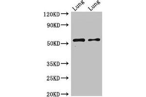 Western Blot Positive WB detected in: Rat lung tissue, Mouse lung tissue All lanes: HTR3A antibody at 2. (Serotonin Receptor 3A Antikörper  (AA 322-455))