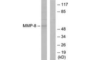 Western Blotting (WB) image for anti-Matrix Metallopeptidase 8 (Neutrophil Collagenase) (MMP8) (AA 418-467) antibody (ABIN2889234) (MMP8 Antikörper  (AA 418-467))