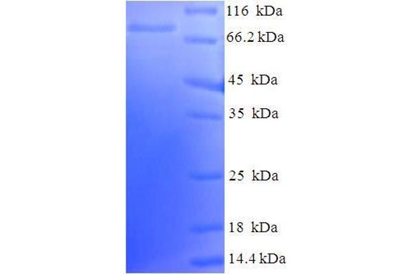 LCK Protein (AA 1-539, Isoform 3) (His-SUMO Tag)