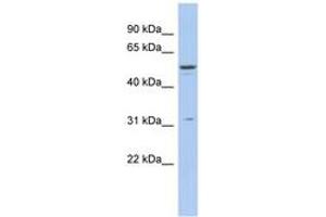 Image no. 1 for anti-Tripartite Motif Containing 14 (TRIM14) (AA 215-264) antibody (ABIN6742515) (TRIM14 Antikörper  (AA 215-264))
