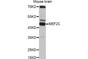 Western blot analysis of extracts of mouse brain, using MEF2C antibody. (MEF2C Antikörper)