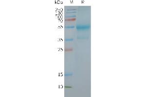 Human C-Nanodisc, Flag Tag on SDS-PAGE (CXCR4 Protein)