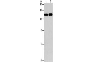 Western Blotting (WB) image for anti-Toll-Like Receptor 3 (TLR3) antibody (ABIN2421026) (TLR3 Antikörper)