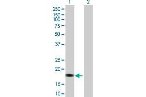 Western Blotting (WB) image for GYPA 293T Cell Transient Overexpression Lysate(Denatured) (ABIN1332065)