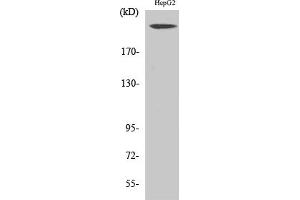 Western Blot analysis of various cells using Neurofibromin Polyclonal Antibody. (Neurofibromin 1 Antikörper  (AA 1520-1600))