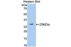 Western Blotting (WB) image for anti-Cyclin D1 (CCND1) (AA 31-295) antibody (ABIN1077956) (Cyclin D1 Antikörper  (AA 31-295))