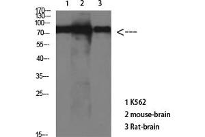 Western Blot analysis of various cells using Antibody diluted at 1:1000. (tau Antikörper)