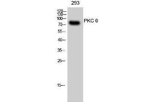Western Blotting (WB) image for anti-Protein Kinase C, theta (PRKCQ) (Thr319) antibody (ABIN3176929) (PKC theta Antikörper  (Thr319))