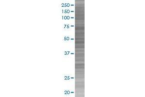 TYR transfected lysate. (TYR 293T Cell Transient Overexpression Lysate(Denatured))