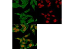 Immunocytochemistry (ICC) image for anti-S100 Calcium Binding Protein A4 (S100A4) antibody (ABIN4949868)