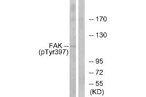Western blot analysis of extracts from 293cells, treated with EGF (200ng/ml, 30mins), using FAK (Phospho-Tyr397) antibody. (FAK Antikörper  (pTyr397))