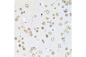 Immunohistochemistry of paraffin-embedded rat brain using RAB3IP antibody. (RAB3IP Antikörper  (AA 1-150))