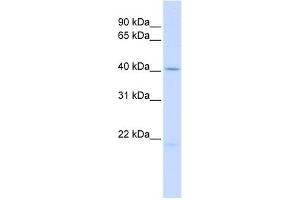 Ectodysplasin A antibody used at 1 ug/ml to detect target protein. (Ectodysplasin A Antikörper  (Middle Region))