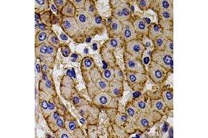 Immunohistochemical analysis of CCR5 staining in human liver formalin fixed paraffin embedded tissue section. (CCR5 Antikörper)