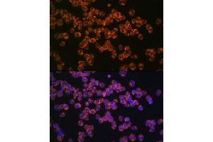 Immunofluorescence analysis of K562 cells using CD127/IL7R Rabbit mAb (ABIN7268005) at dilution of 1:100 (40x lens). (IL7R Antikörper)