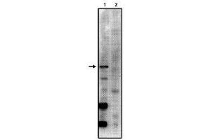 Image no. 1 for anti-Protein Phosphatase 2, Regulatory Subunit B', gamma (PPP2R5C) (AA 53-66) antibody (ABIN264946) (PPP2R5C Antikörper  (AA 53-66))