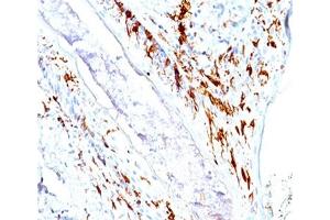 IHC testing of human skin stained with CD1a antibody cocktail (O10 + C1A/711). (CD1a Antikörper)