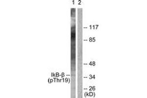 Western blot analysis of extracts from 293 cells treated with TNF-a 20ng/ml 30', using IkappaB-beta (Phospho-Thr19) Antibody. (NFKBIB Antikörper  (pThr19))