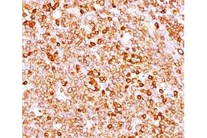 IHC testing of human tonsil (20X) stained with CD79a antibody cocktail (JCB117 + HM47/A9). (CD79a Antikörper  (AA 202-216))