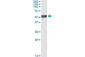 Immunoprecipitation of ALDH1A1 transfected lysate using rabbit polyclonal anti-ALDH1A1 and Protein A Magnetic Bead (ALDH1A1 (Human) IP-WB Antibody Pair)