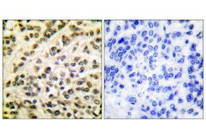 Immunohistochemistry (IHC) image for anti-Friend Leukemia Virus Integration 1 (FLI1) (Internal Region) antibody (ABIN1848550) (FLI1 Antikörper  (Internal Region))