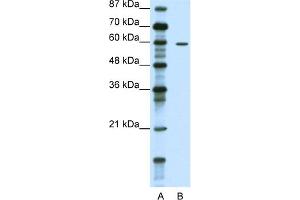 WB Suggested Anti-TRIM62 Antibody Titration:  1. (TRIM62 Antikörper  (N-Term))