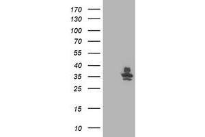 Western Blotting (WB) image for anti-Retinaldehyde Binding Protein 1 (RLBP1) antibody (ABIN1497624) (RLBP1 Antikörper)