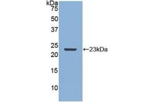Detection of Recombinant MMP12, Rabbit using Polyclonal Antibody to Matrix Metalloproteinase 12 (MMP12) (MMP12 Antikörper  (AA 286-464))