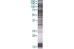 TFCP2 transfected lysate. (TFCP2 293T Cell Transient Overexpression Lysate(Denatured))