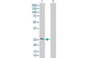 Western Blotting (WB) image for FOLR1 293T Cell Transient Overexpression Lysate(Denatured) (ABIN1331861)