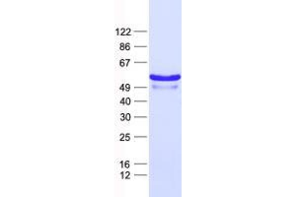 ZNF200 Protein (His tag)