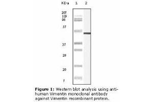 Image no. 2 for anti-Vimentin (VIM) antibody (ABIN232124) (Vimentin Antikörper)
