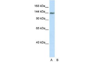 Western Blot showing TIMELESS antibody used at a concentration of 1-2 ug/ml to detect its target protein. (TIMELESS Antikörper  (C-Term))