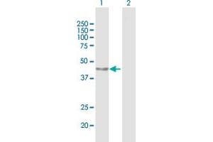 Western Blot analysis of PARP15 expression in transfected 293T cell line by PARP15 MaxPab polyclonal antibody. (PARP15 Antikörper  (AA 1-444))