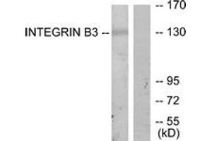 Western blot analysis of extracts from HepG2 cells, using Integrin beta3 (Ab-773) Antibody. (Integrin beta 3 Antikörper  (AA 731-780))