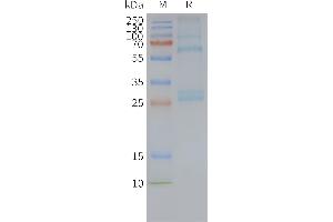 SDS-PAGE (SDS) image for ADGRG1 protein (ABIN7538124)