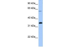 WB Suggested Anti-FBXO16 Antibody Titration: 0. (FBXO16 Antikörper  (C-Term))