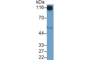 Detection of CD26 in Human Placenta lysate using Polyclonal Antibody to Cluster Of Differentiation 26 (CD26) (DPP4 Antikörper  (AA 484-728))